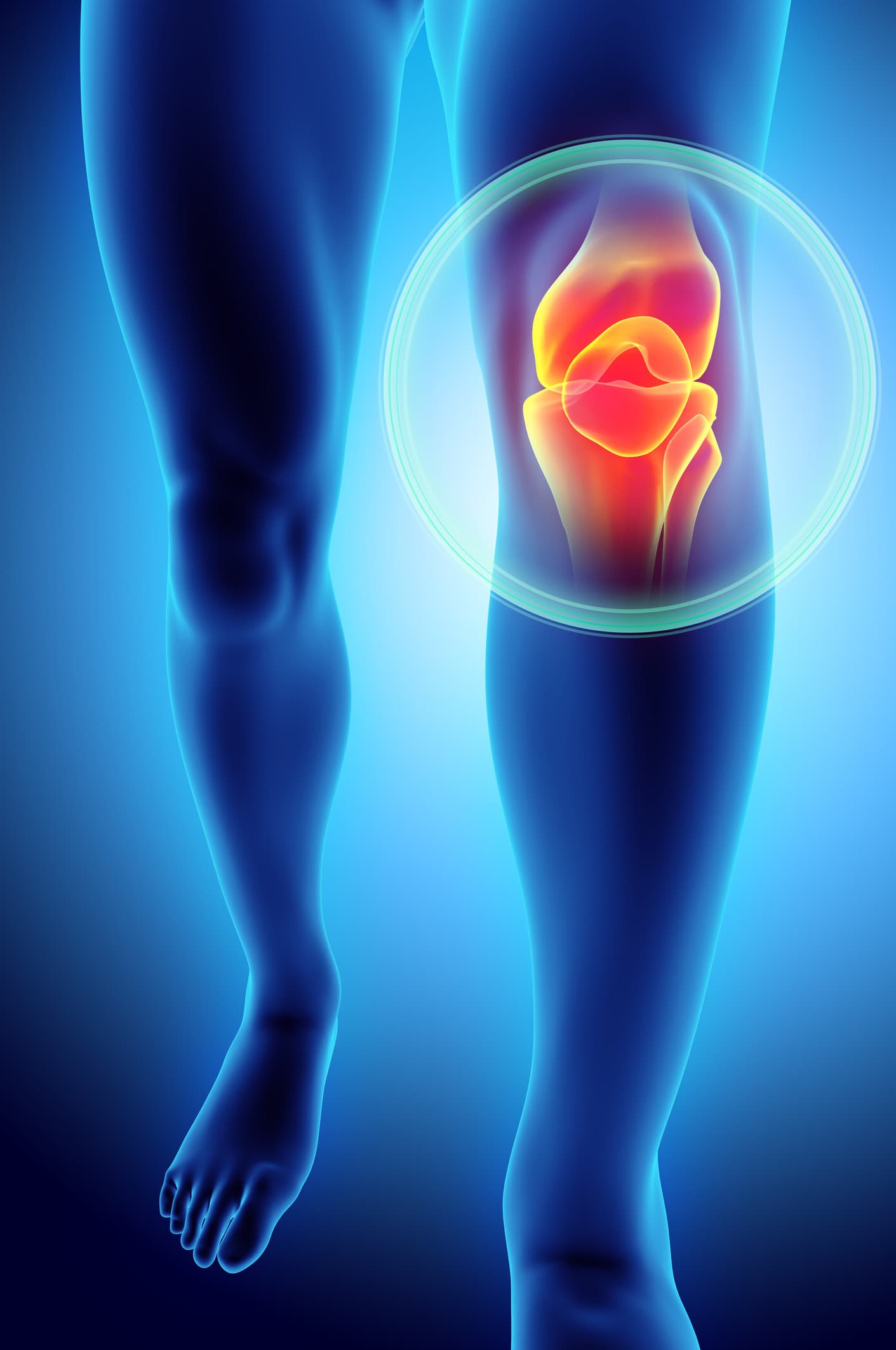 Knee Pain at Amazing Physiotherapy