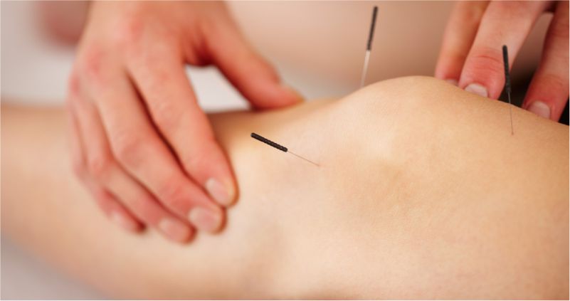 Acupuncture 2