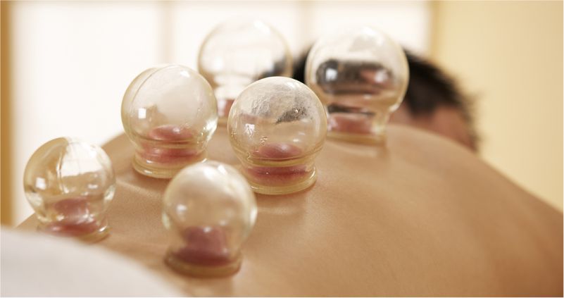 Cupping
